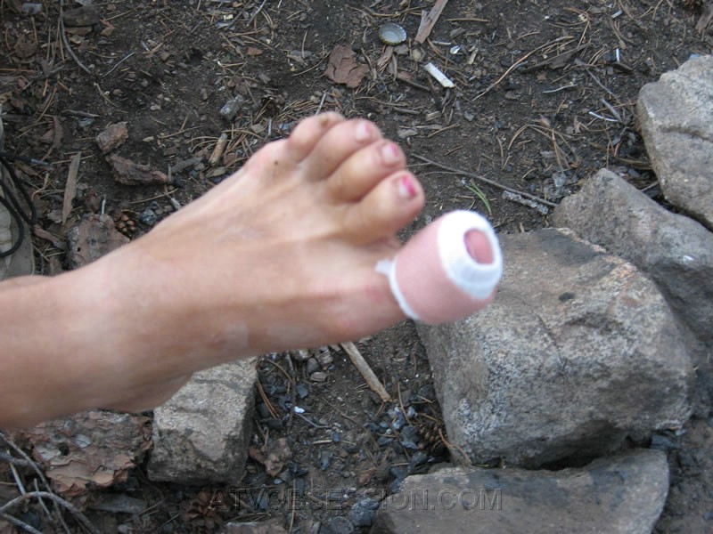 145. I guess those ski boots were too tight..jpg